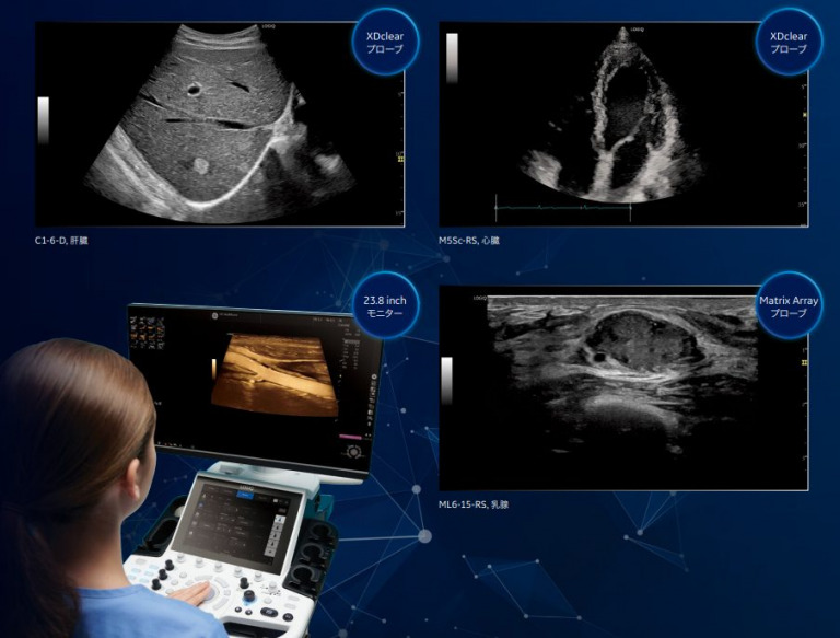 GE 超音波診断装置 LOGIQ P10 (ロジックP10) 動物病院開業サポート 株式会社M&T（エムアンドティー）
